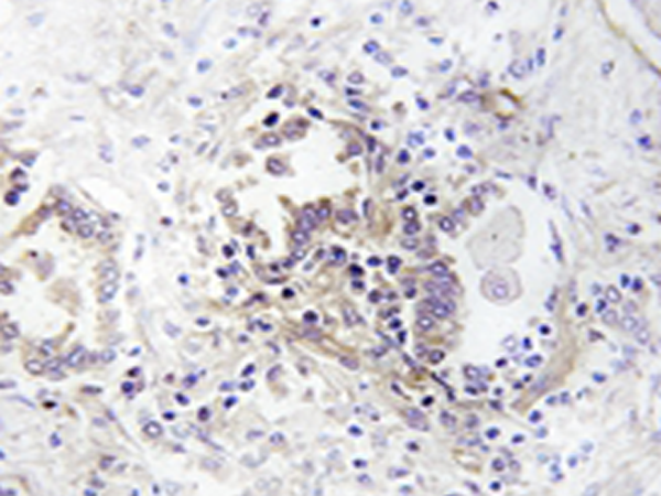 兔抗CHML多克隆抗体