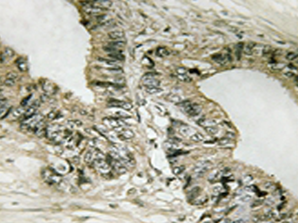 兔抗GAB2(Phospho-Ser623) 多克隆抗体