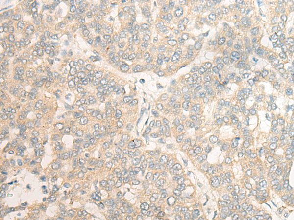 兔抗CPVL多克隆抗体