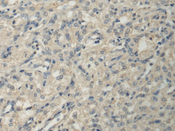 兔抗PPM1A多克隆抗体