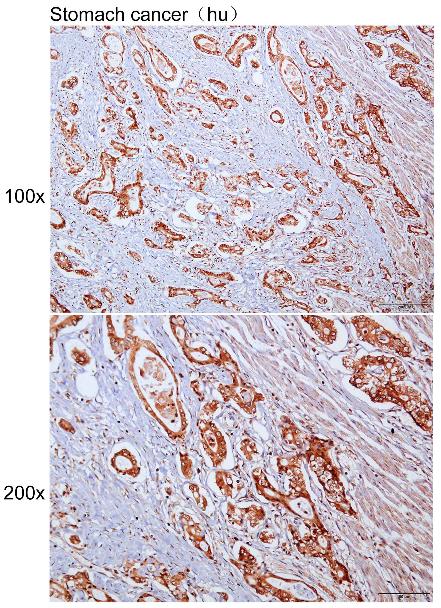 Anti-SFN Polyclonal Antibody