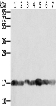 兔抗PPIA多克隆抗体