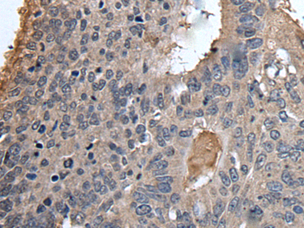 兔抗UBR2多克隆抗体