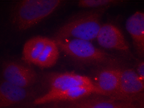 兔抗TH(Phospho-Ser40) 多克隆抗体
