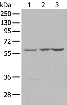 兔抗SETD3多克隆抗体
