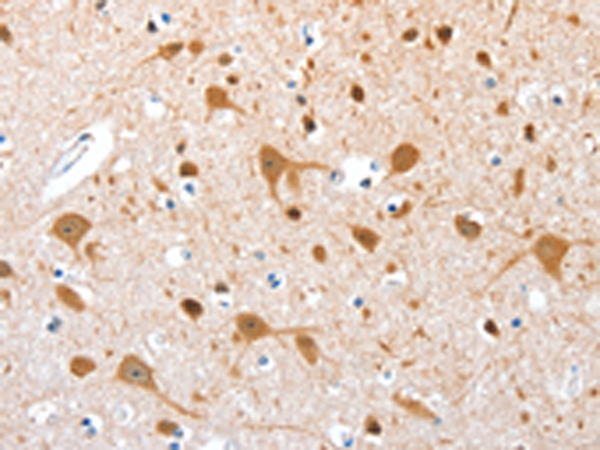 兔抗AEBP2多克隆抗体