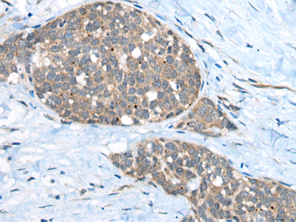 兔抗UBE2G2多克隆抗体
