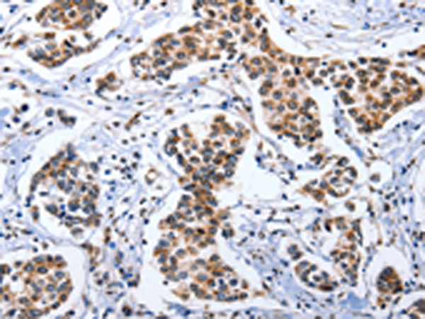 兔抗DOK3多克隆抗体