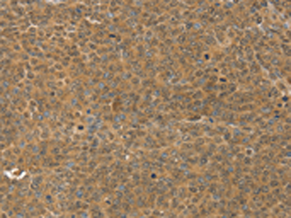 兔抗MED15多克隆抗体