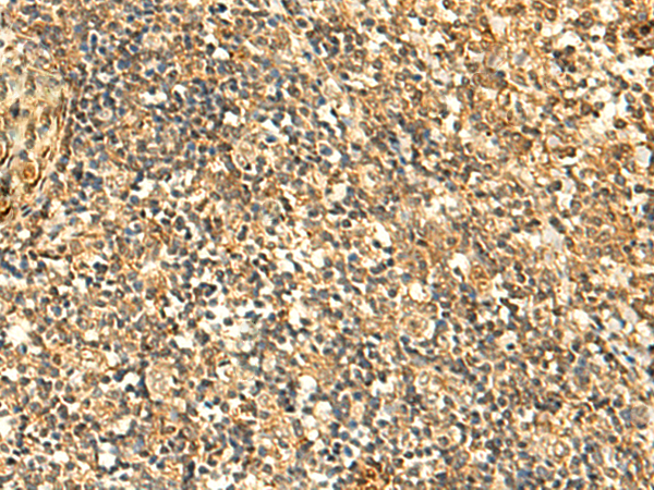 兔抗GLYATL2多克隆抗体