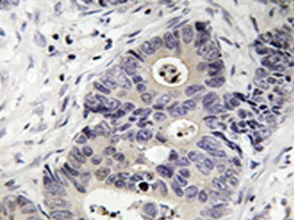 兔抗NOS2(Phospho-Tyr151)多克隆抗体