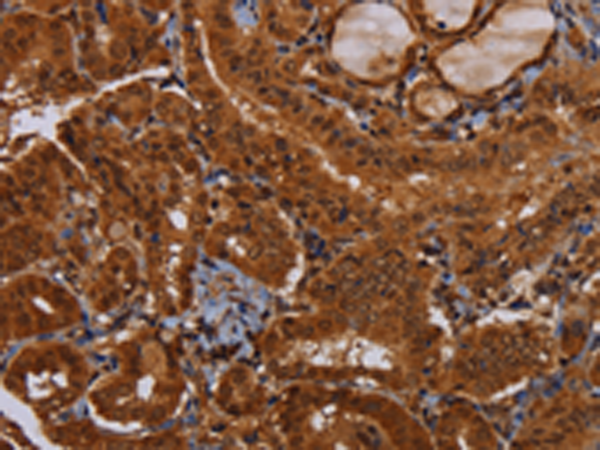 兔抗WDR83多克隆抗体