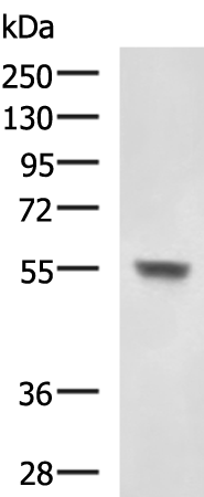 兔抗CHST3多克隆抗体