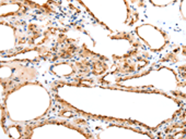 兔抗SETD3多克隆抗体