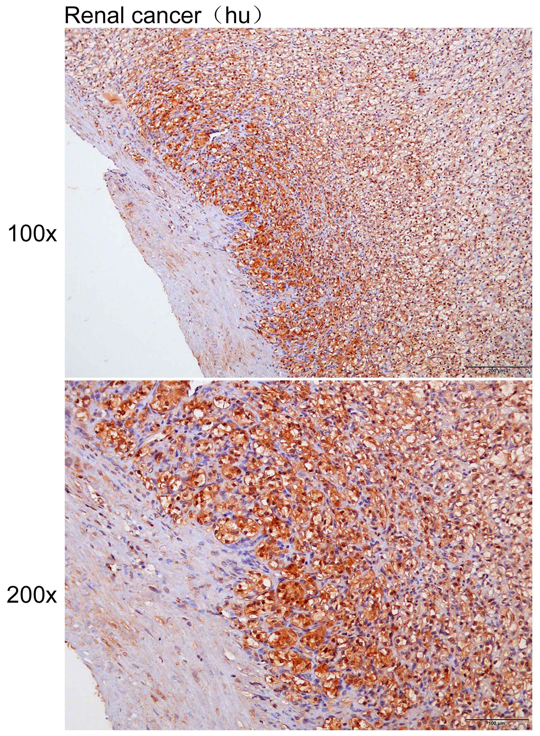 Anti-SFN Polyclonal Antibody