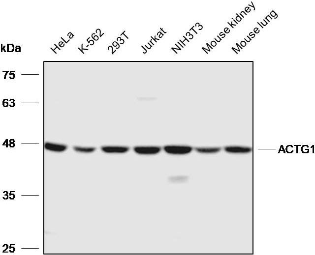 Anti-ACTG1 Polyclonal Antibody