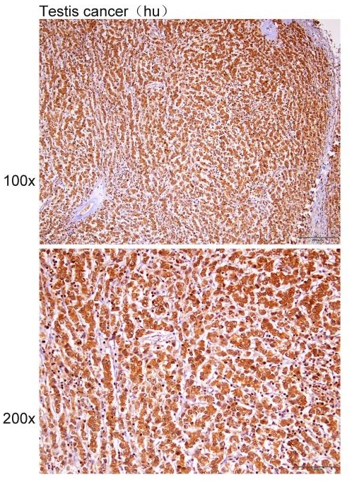 Anti-GADD45 Polyclonal Antibod