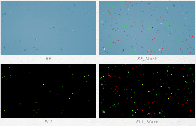 血小板的研究应用及影响血小板计数准确性的因素