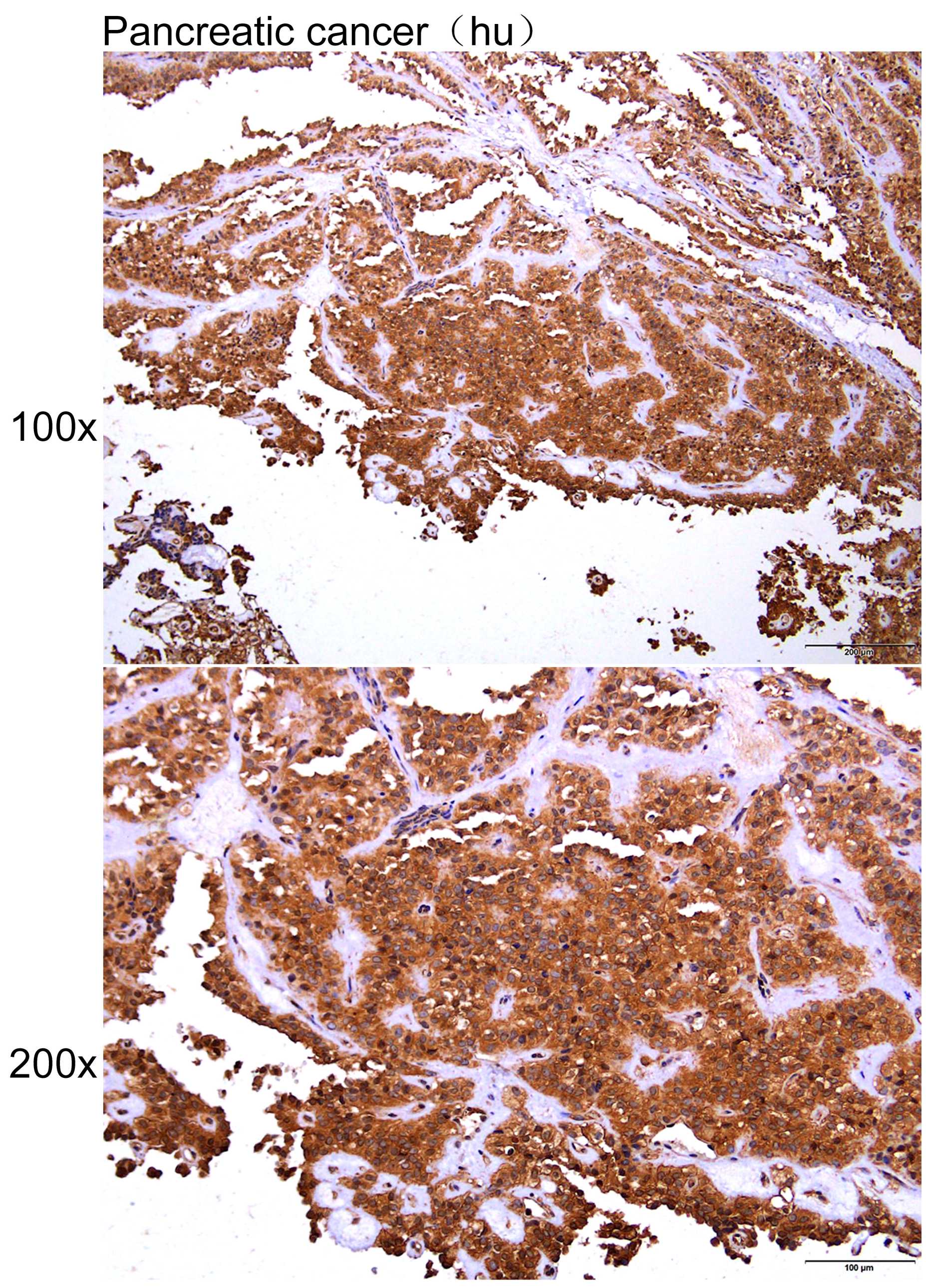 Anti-ACTG1 Polyclonal Antibody