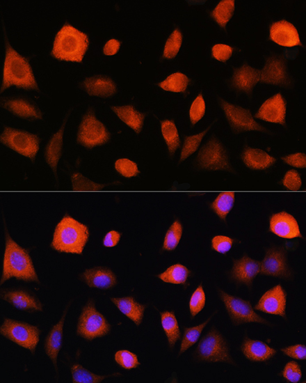 Anti-EIF2B5 Polyclonal Antibod