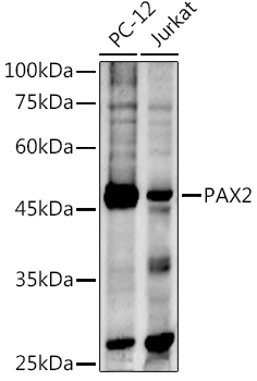 Anti-PAX2 Polyclonal Antibody