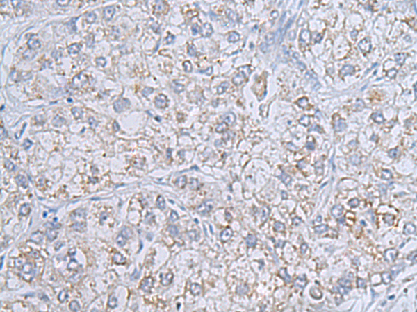 兔抗RAB20多克隆抗体