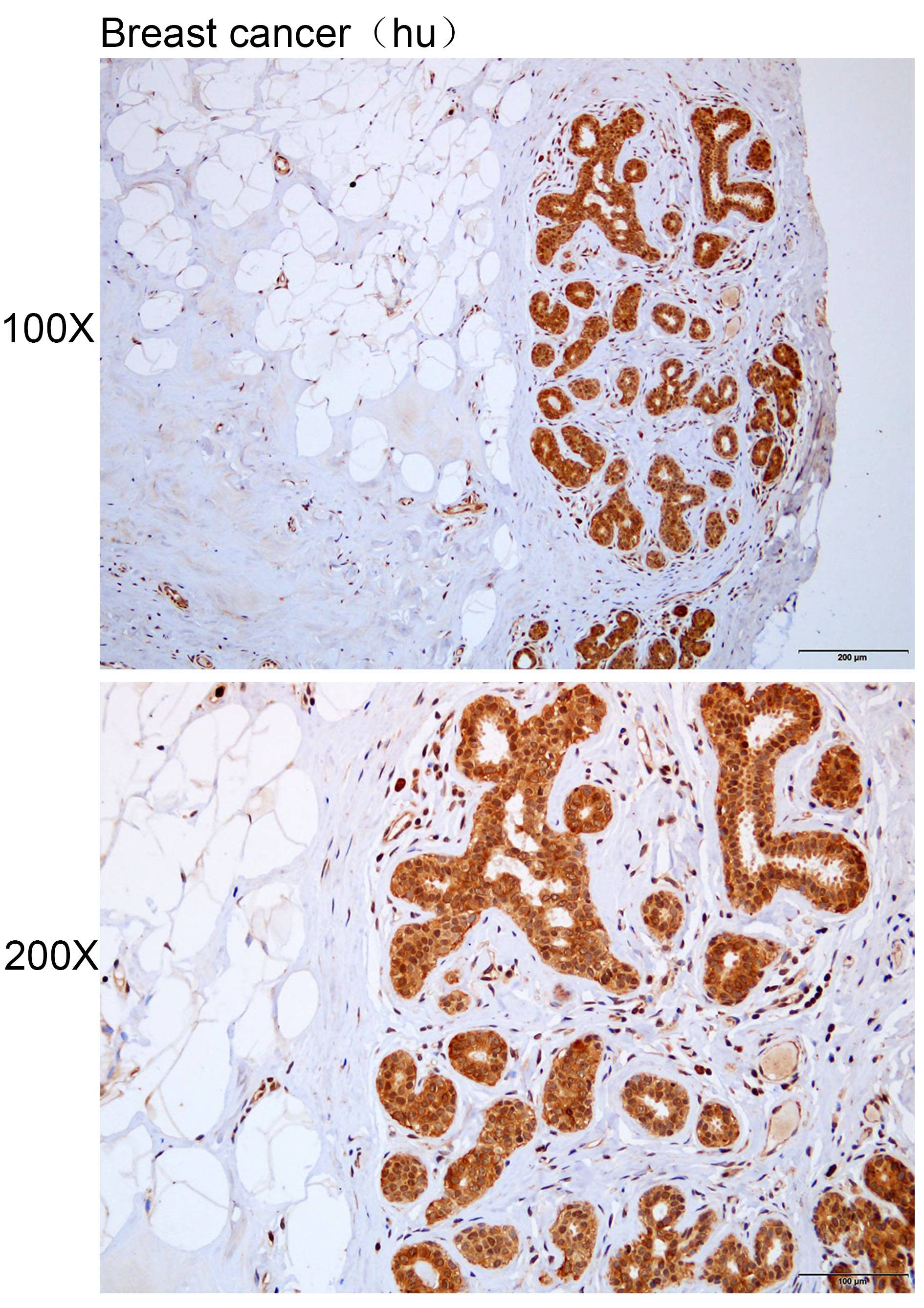 Anti-ACOT13 Polyclonal Antibod