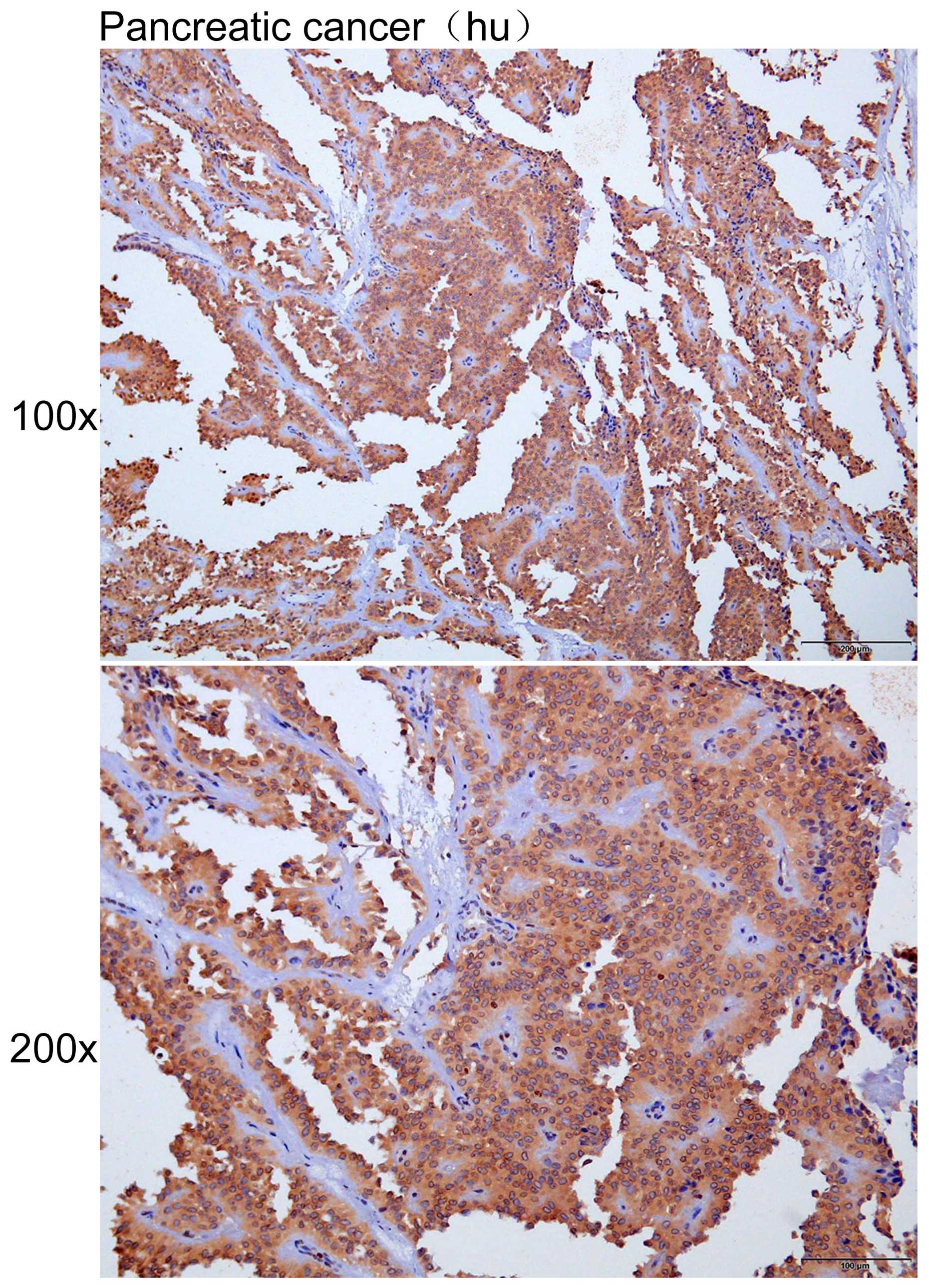 Anti-SFN Polyclonal Antibody