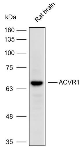 Anti-ACVR1 Polyclonal Antibody