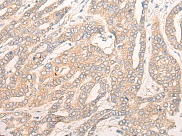 兔抗DALRD3多克隆抗体