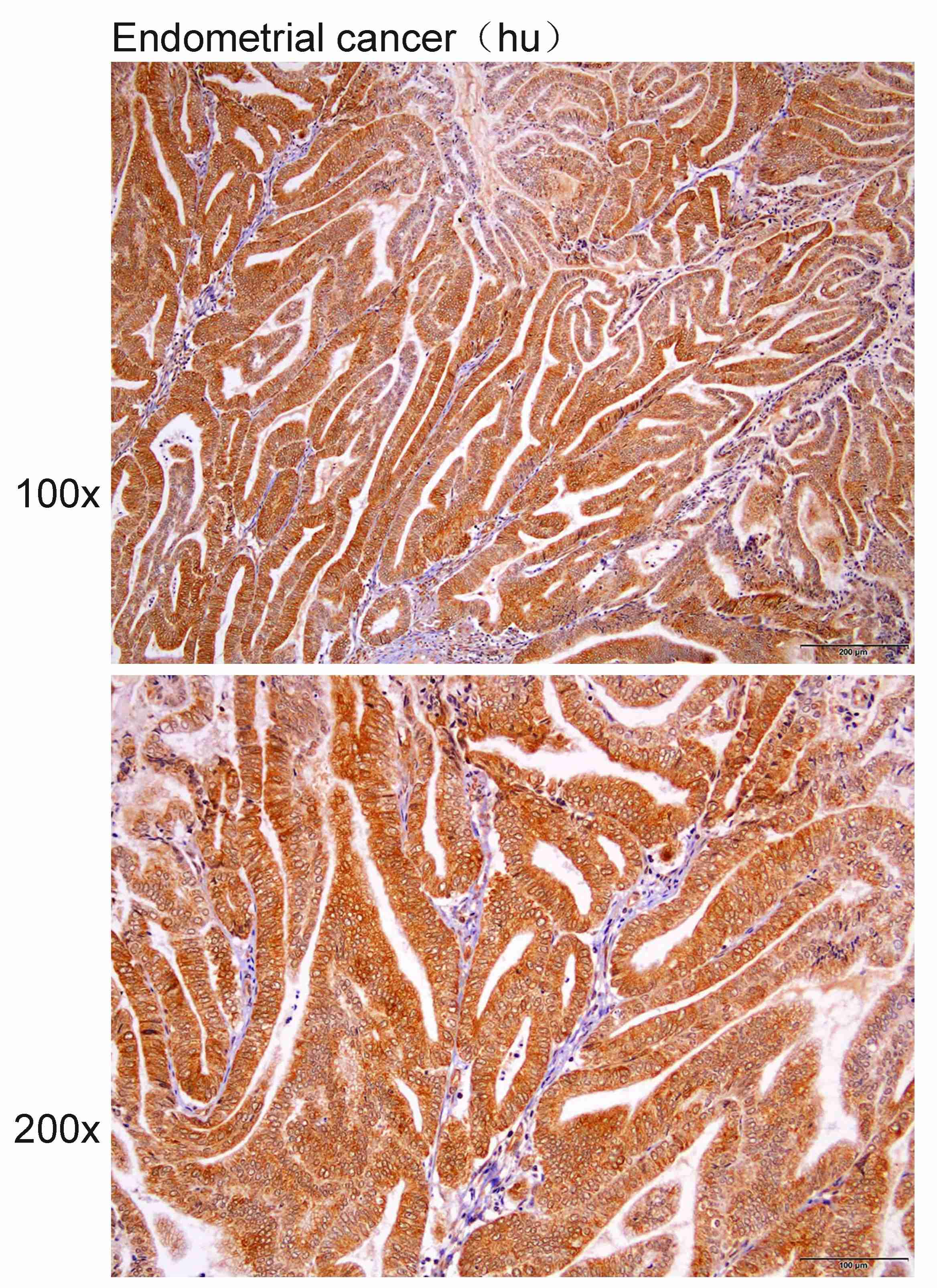 Anti-UCHL5IP Polyclonal Antibo