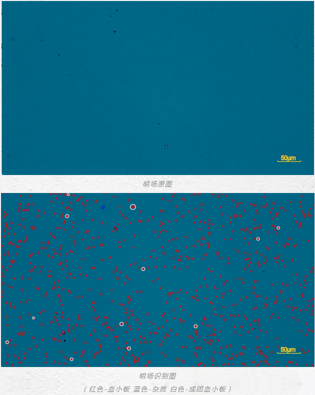 血小板的研究应用及影响血小板计数准确性的因素