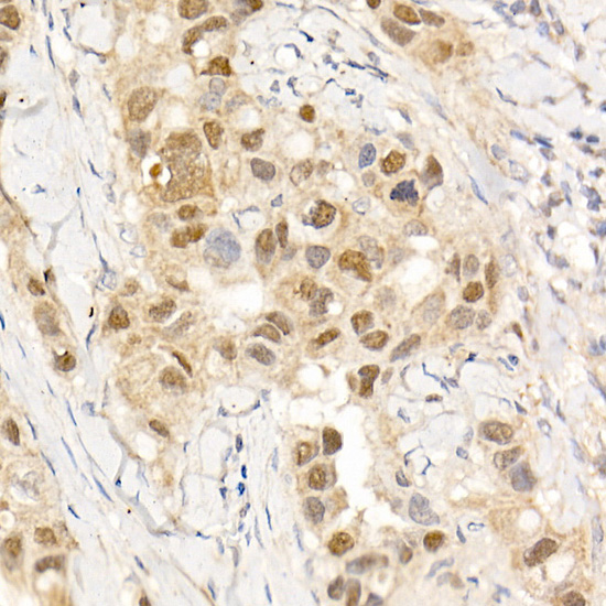 Anti-ABL1 Polyclonal Antibody