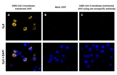 SARS-CoV-2 Membrane Protein Pr