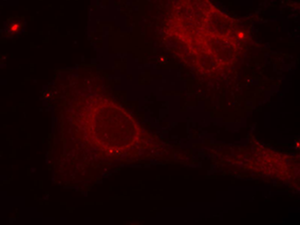 兔抗SHC1 (Phospho-Tyr349)多克隆抗体