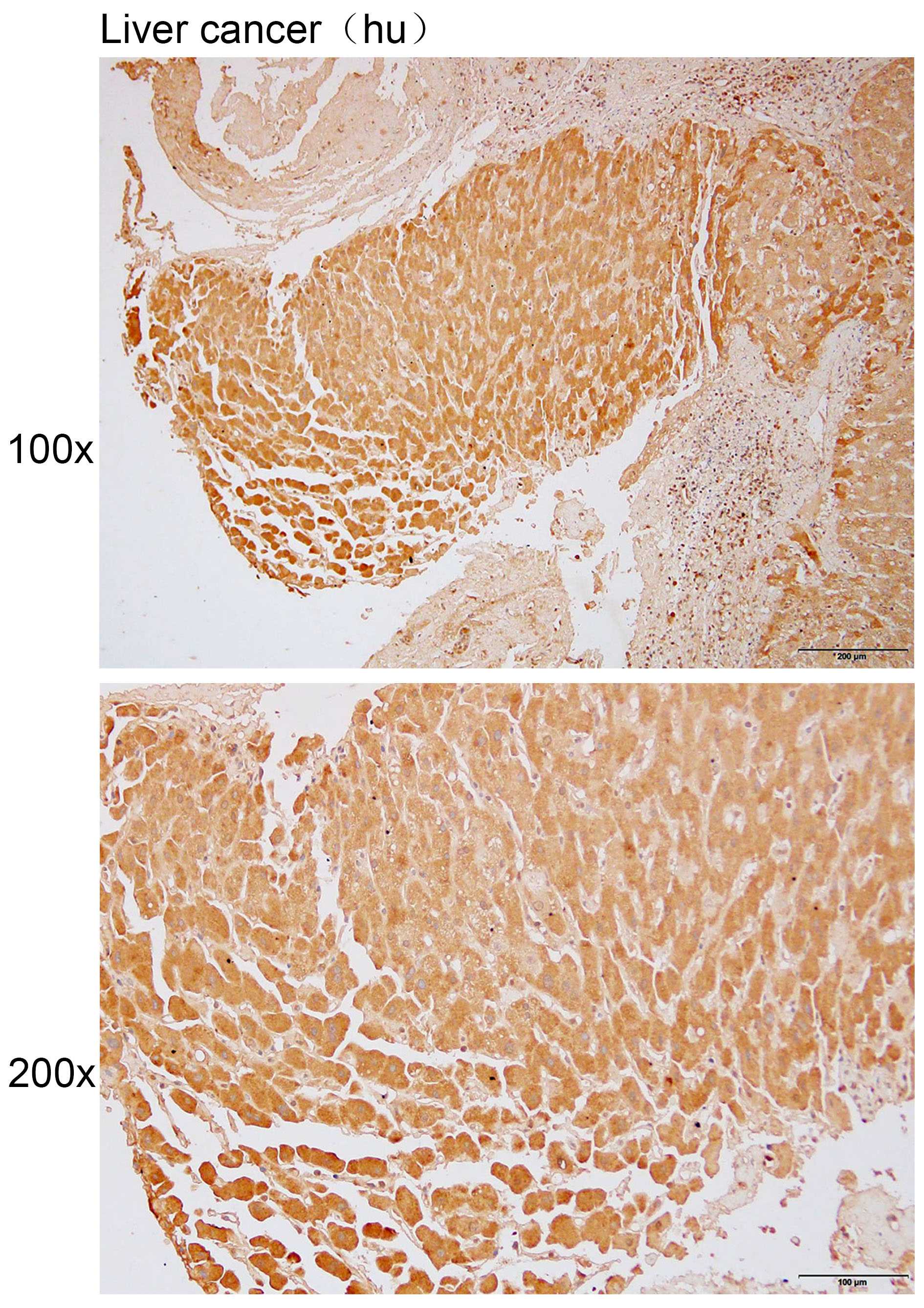 Anti-ABCA8 Polyclonal Antibody