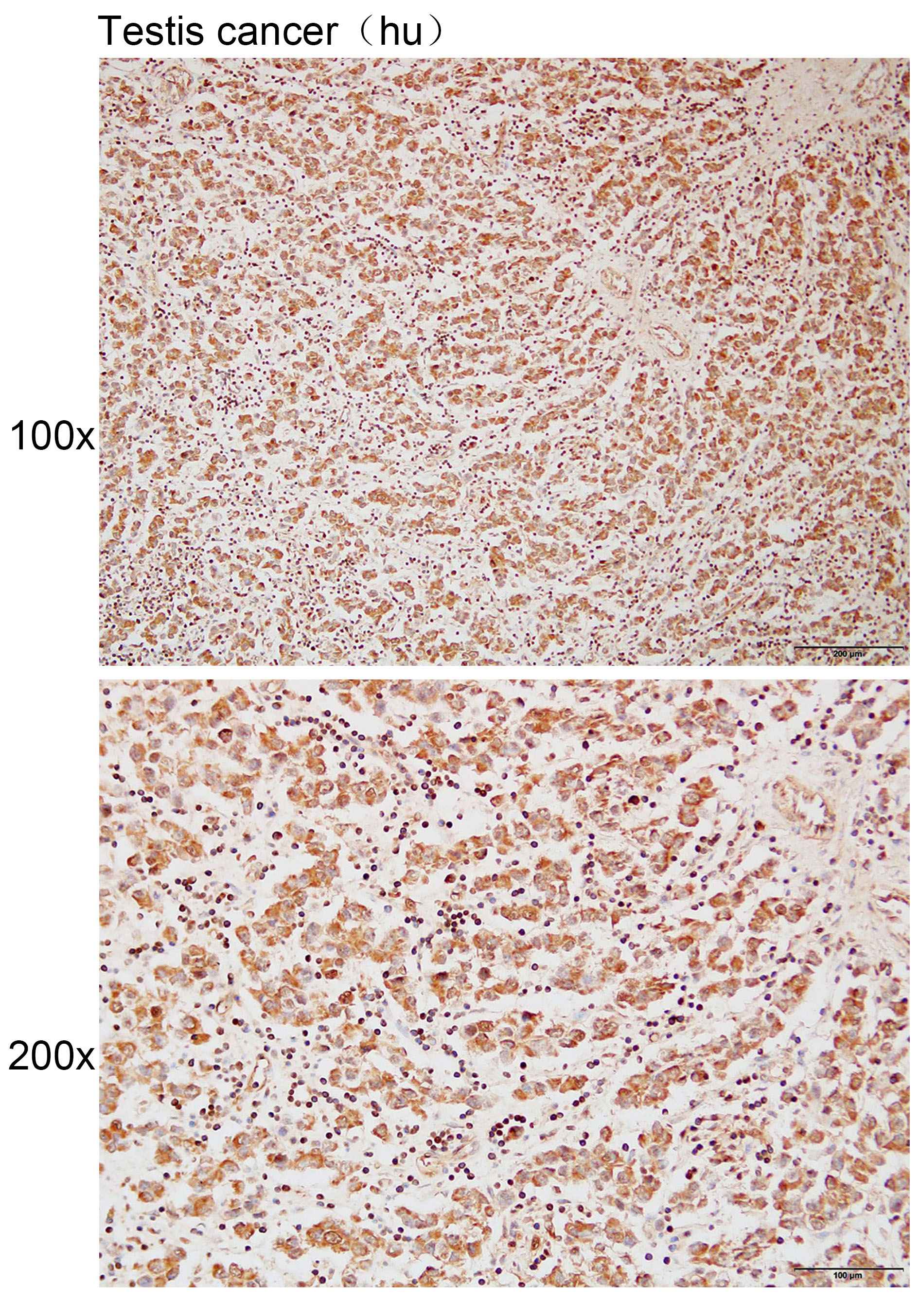 Anti-ACTL7B Polyclonal Antibod