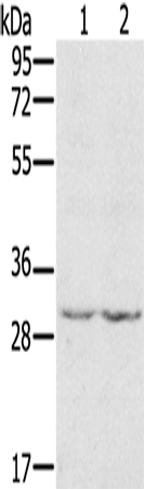 兔抗WDR83多克隆抗体