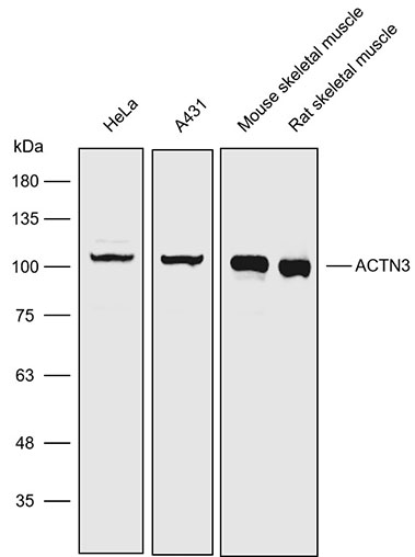 Anti-ACTN3 Polyclonal Antibody