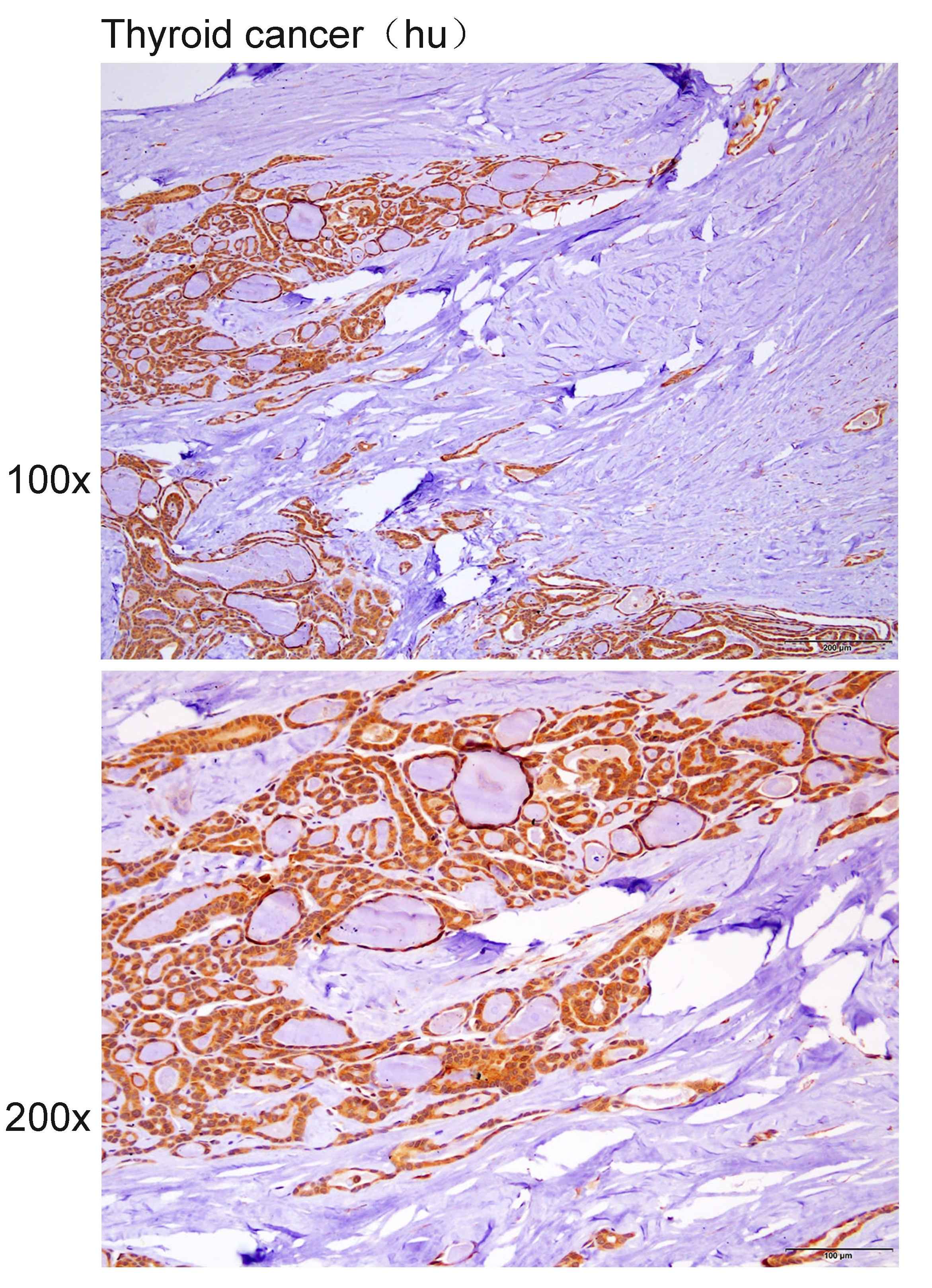 Anti-WDFY3 Polyclonal Antibody