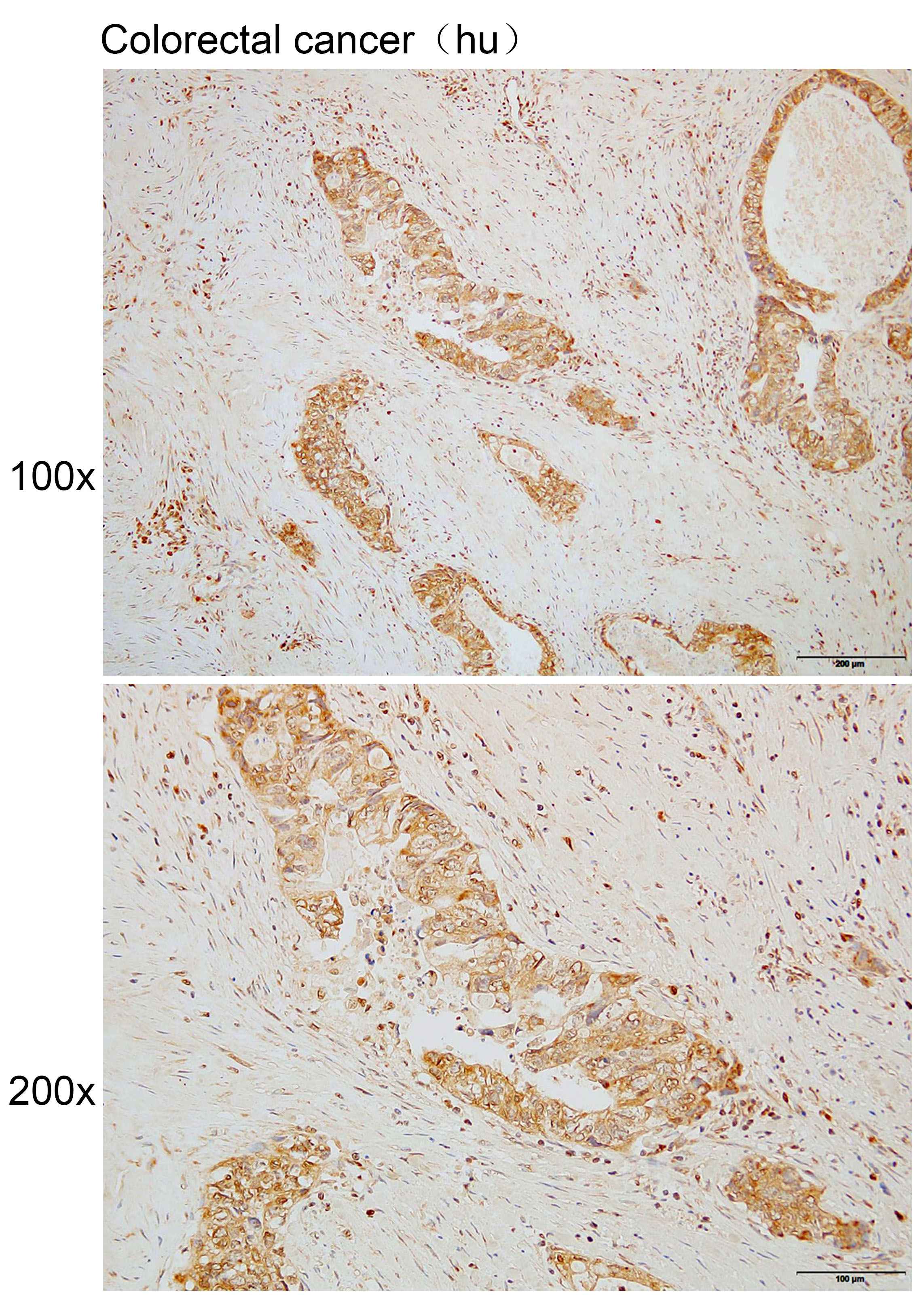Anti-ACSS1 Polyclonal Antibody