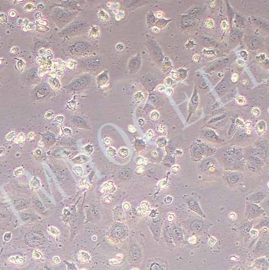 SAOS-2-LUC(人成骨肉瘤细胞-荧光素酶标记)