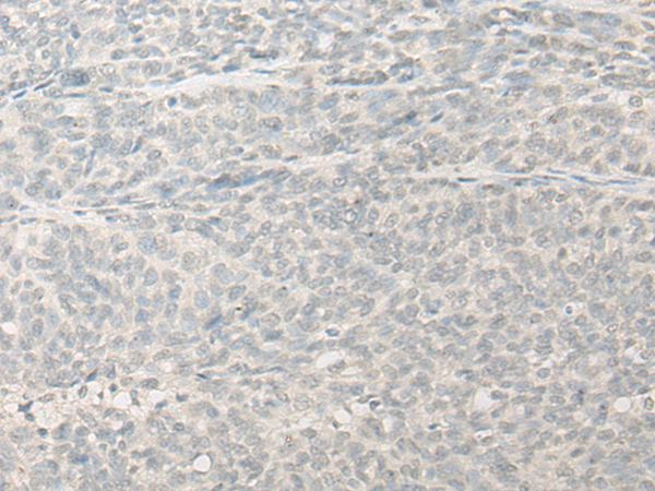 兔抗RSPH14多克隆抗体