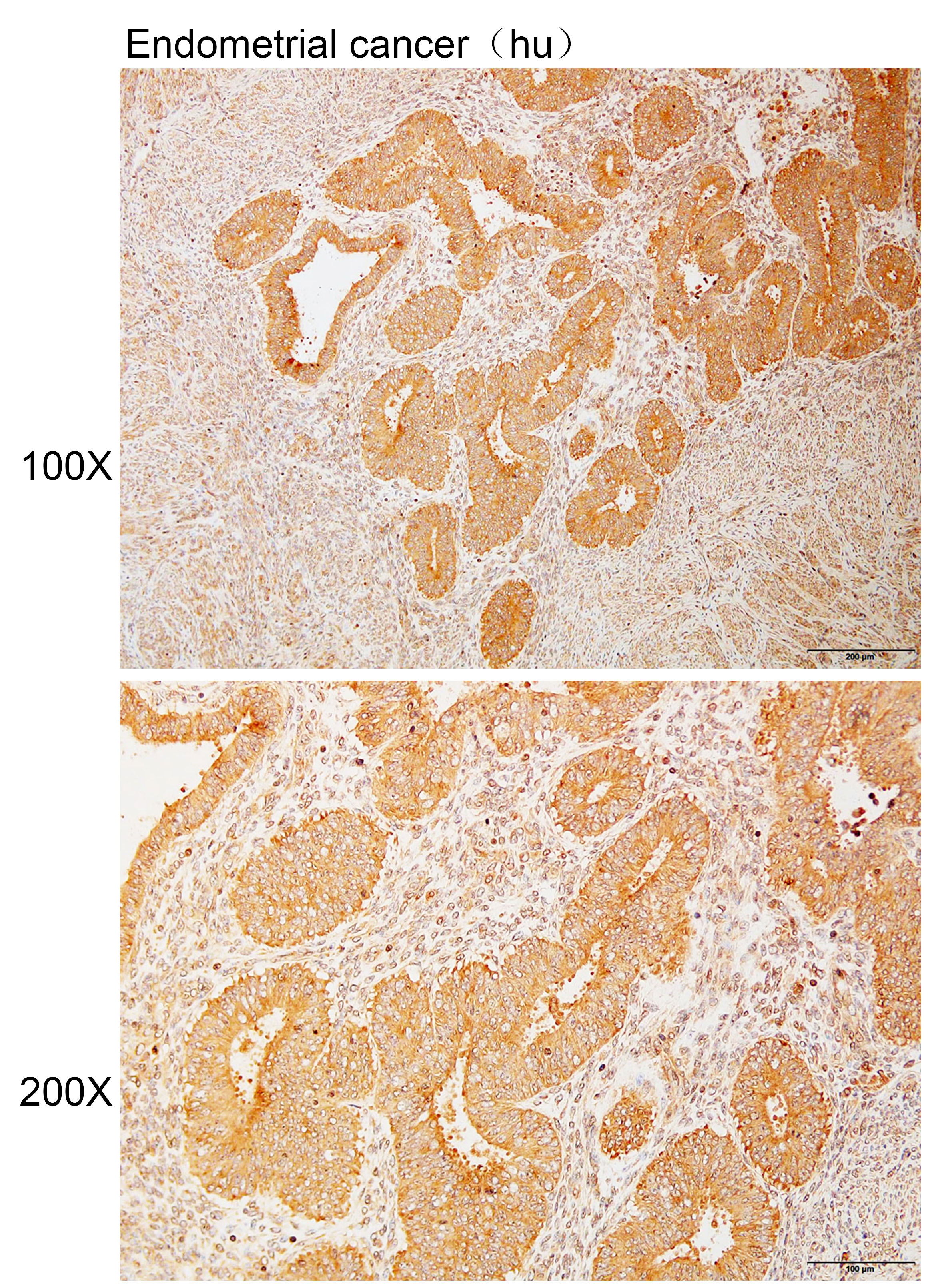 Anti-ABCB7 Polyclonal Antibody