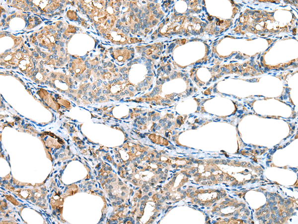 兔抗RPL35A多克隆抗体