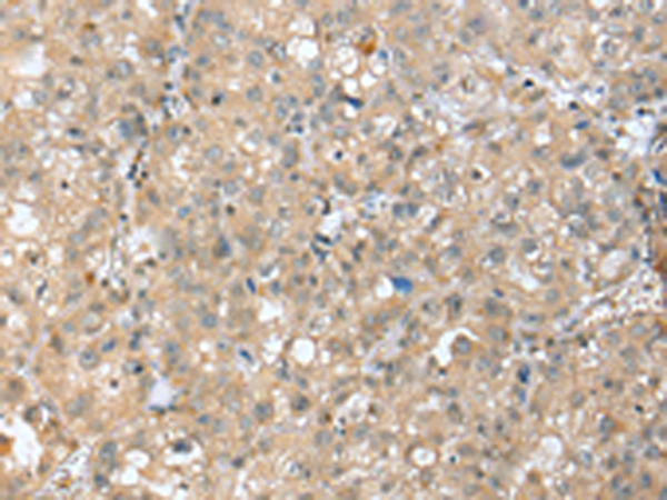 兔抗SETD3多克隆抗体