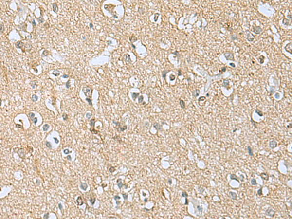 兔抗APOBR多克隆抗体