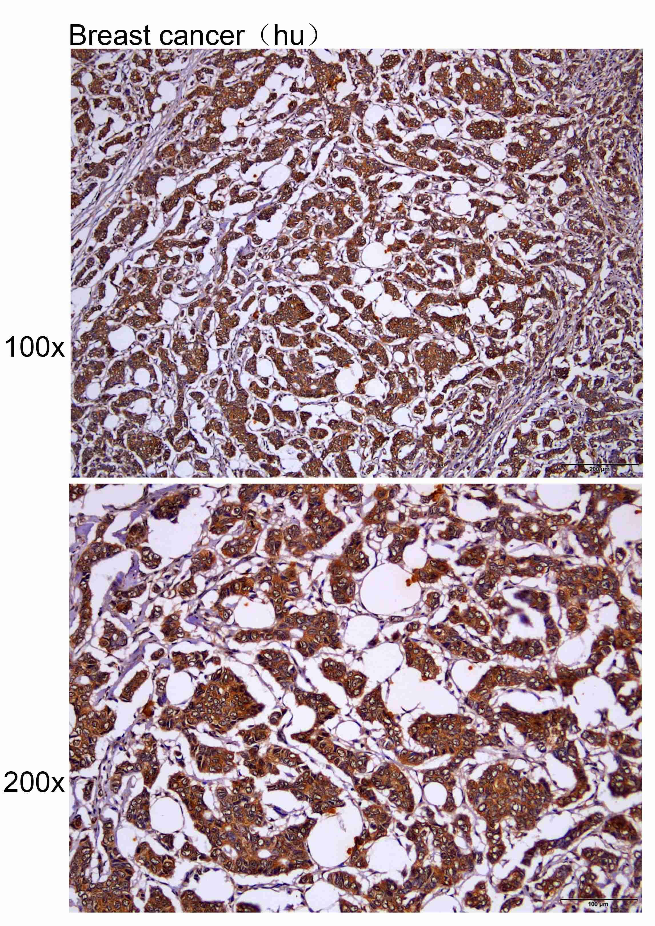 Anti-TUBA3C Polyclonal Antibod