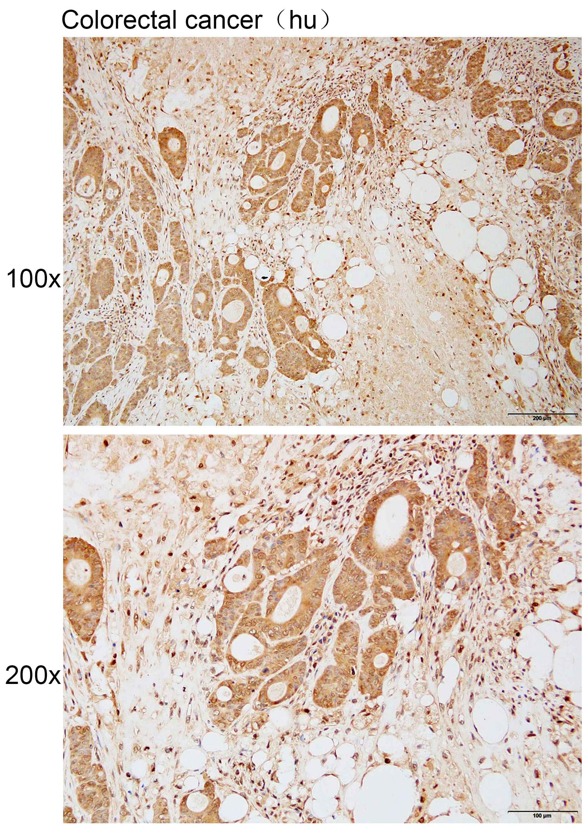 Anti-ACTL7B Polyclonal Antibod