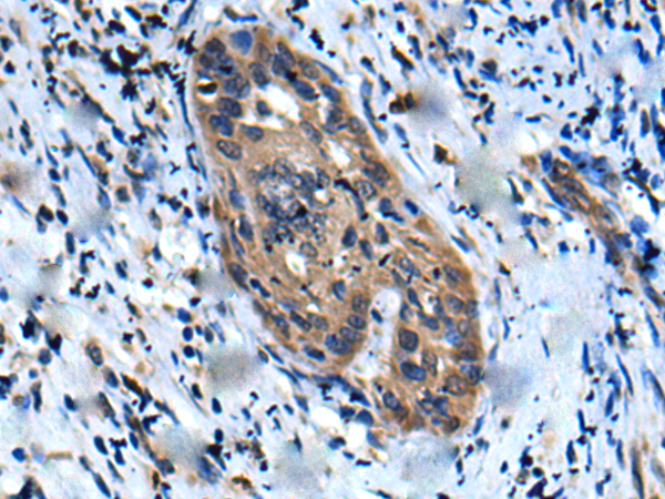 兔抗UBR2多克隆抗体